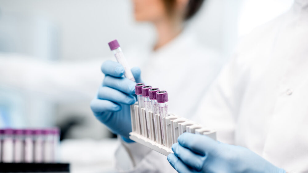 What Laboratory Errors Warrant a Medical Malpractice Claim in Pennsylvania?