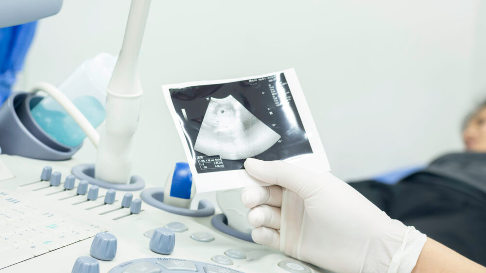 Pittsburgh Placenta Previa Birth Injury Lawyer