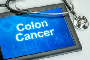 Signs of Colon Cancer You Should Not Ignore