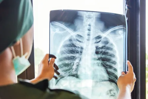 Impact of Failing to Read an MRI, X-Ray, or Mammogram Correctly