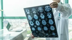 Traumatic Brain Injury Attorney in Pittsburgh, PA