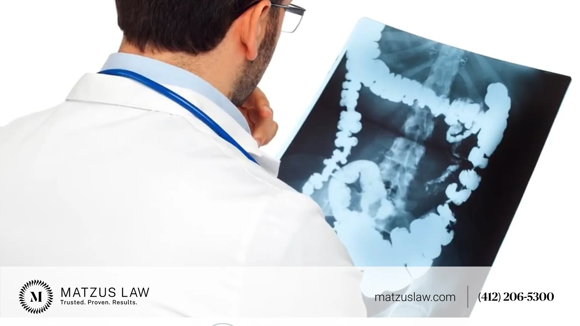 Colon Cancer Misdiagnosis