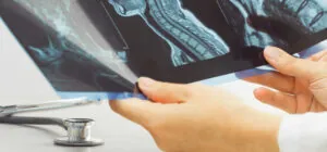 Spinal Cord Injury Attorney in Pittsburgh, PA