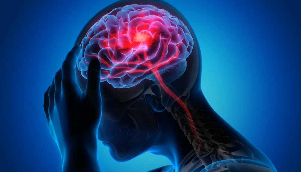 Misdiagnosed Brain Injury