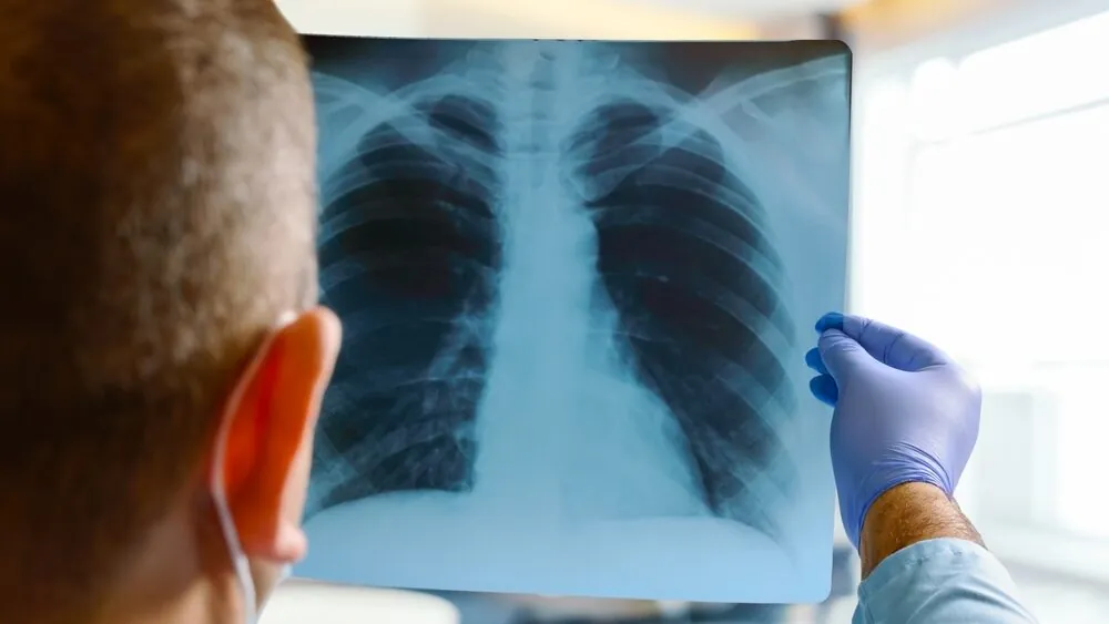 Radiology Malpractice: Misinterpretation of CT Scan Resulting in a Patient’s Death