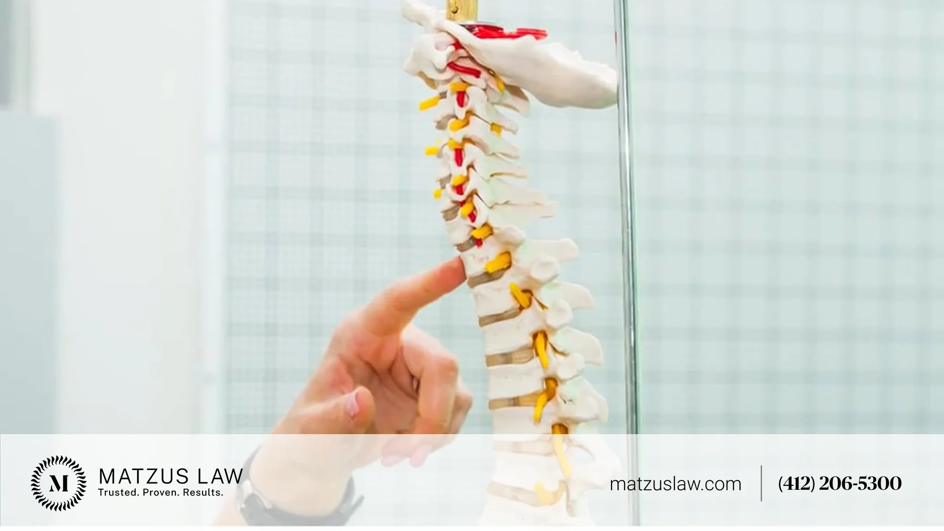 Spinal Cord Injury