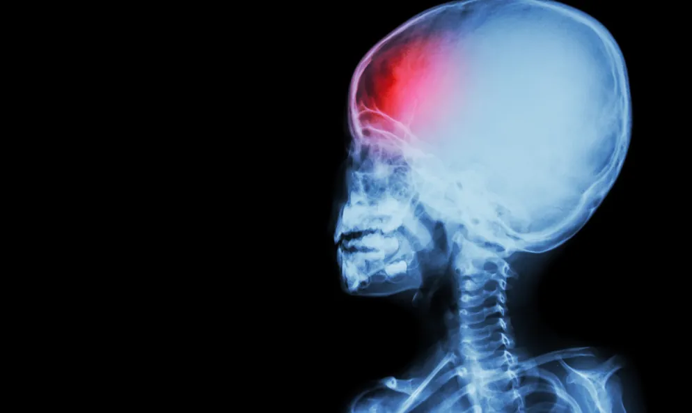 HIE Birth Injury Attorney in Pittsburgh, PA