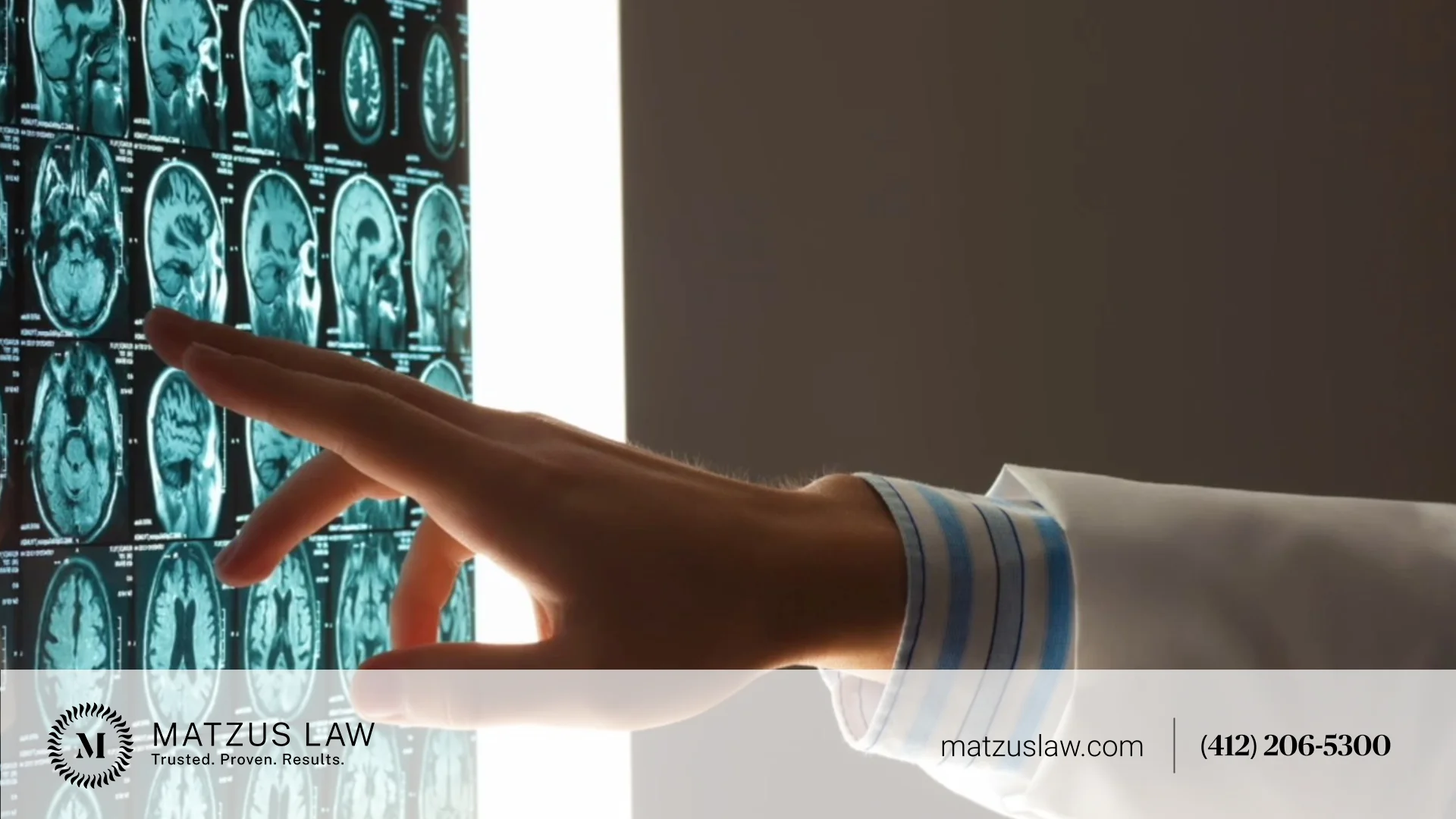What are the circumstances in which a retakes diagnosis occurs?