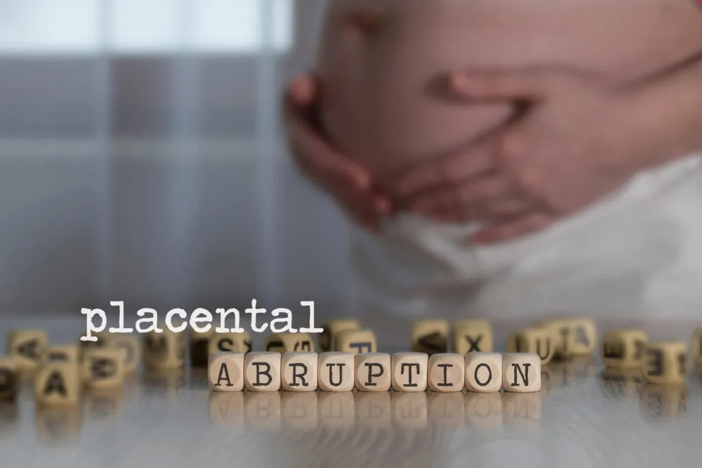 How Placental Abruption Is Mismanaged in PA